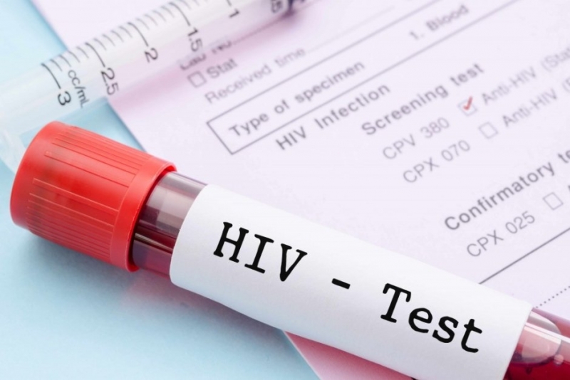 Вирусът ХИВ е установен у жител на област Враца научи