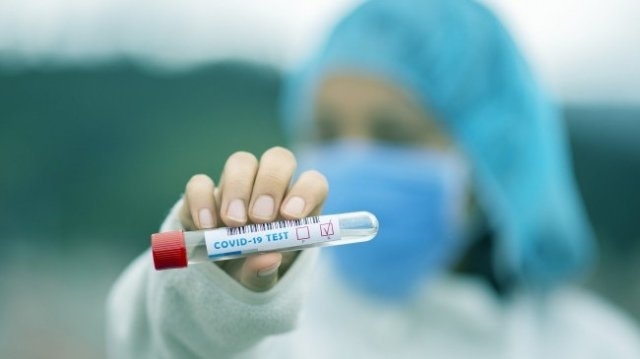 Кипър регистрира рекорден брой на заразени с коронавируса за денонощие
