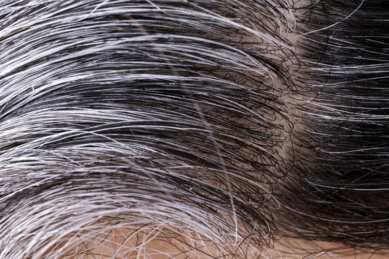 Консумацията на определени храни ускорява появата на сива коса, предупреди