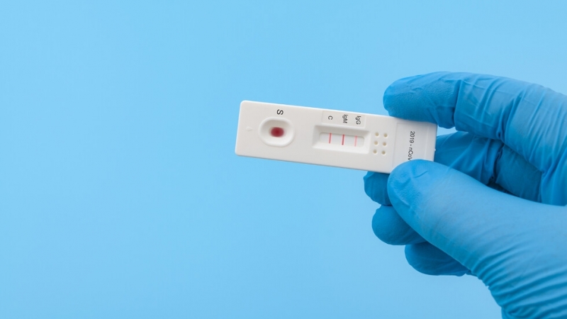 Турция въвежда изискване за представяне на негативен PCR Sars CoV 2 тест