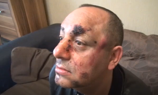 Мъж от Видин e бил пребит от шофьори на тежкотоварни