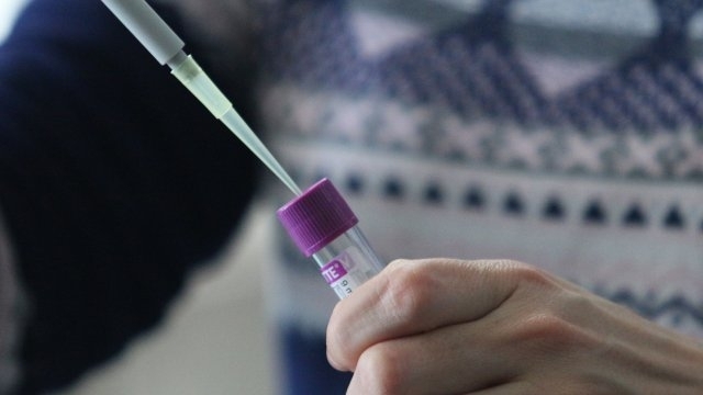 Броят на потвърдените случаи на коронавирус в Русия нарасна с