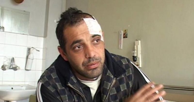 Мъж от Велико Търново вече четири години живее с куршум