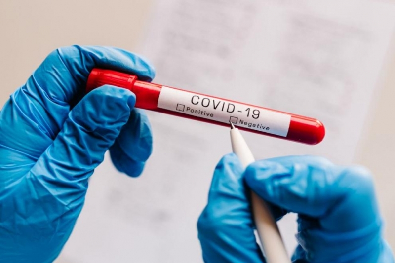 2462 са новите случаи на коронавирус у нас 11 2