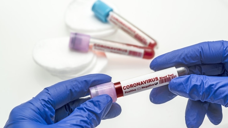 Регистрирани са два нови случая на коронавирус в област Видин,
