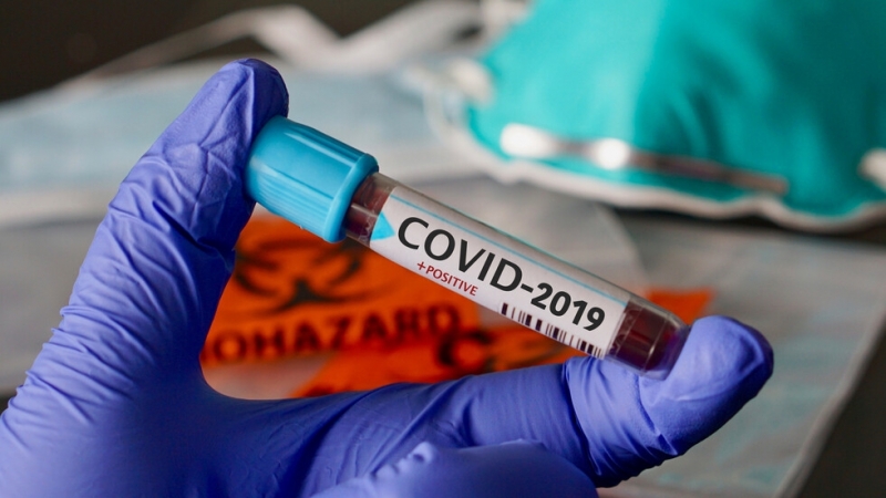 133 са новите случая на коронавирус, регистрирани през последното денонощие