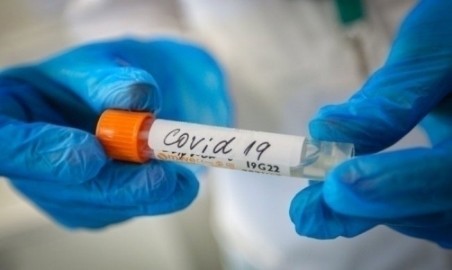 42 са новите случаи на зараза с COVID-19 за последното